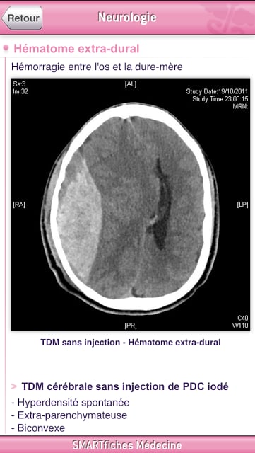 SMARTfiches Neurologie FREE截图10