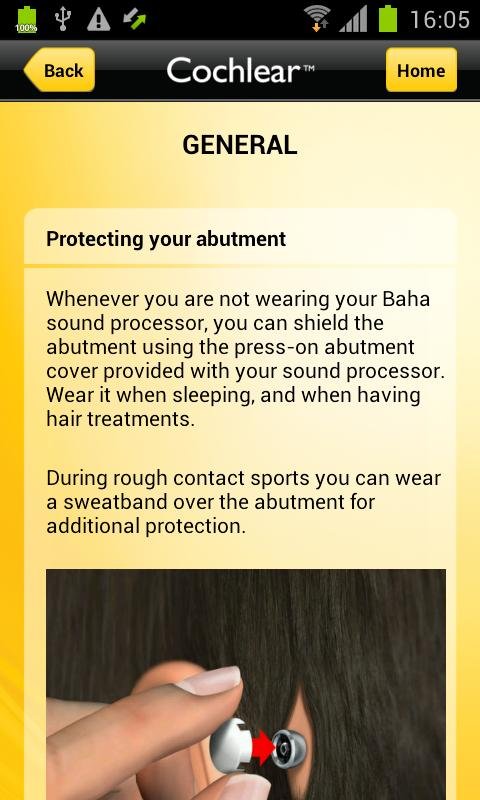 Cochlear Baha Support截图2