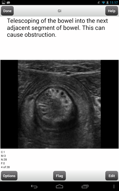 ARRT Sonography (Ultrasound) Flashcards Lite截图10