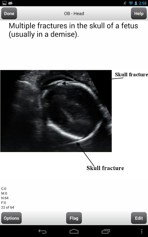 ARRT Sonography (Ultrasound) Flashcards Lite截图8