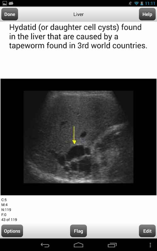 ARRT Sonography (Ultrasound) Flashcards Lite截图6