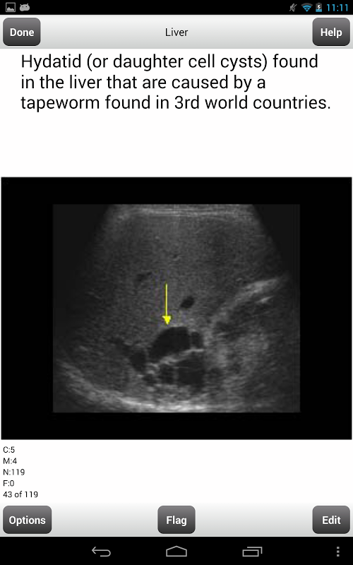 ARRT Sonography (Ultrasound) Flashcards Lite截图11