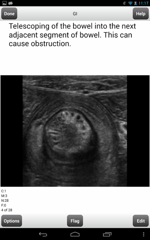 ARRT Sonography (Ultrasound) Flashcards Lite截图7