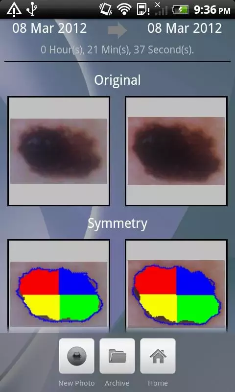 Doctor Mole - Skin cancer app截图5