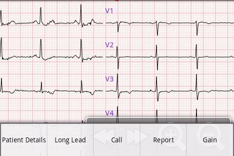 eUno R10 Mobile Telecardiology截图3