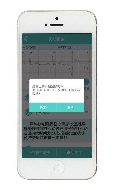 特特心电截图4