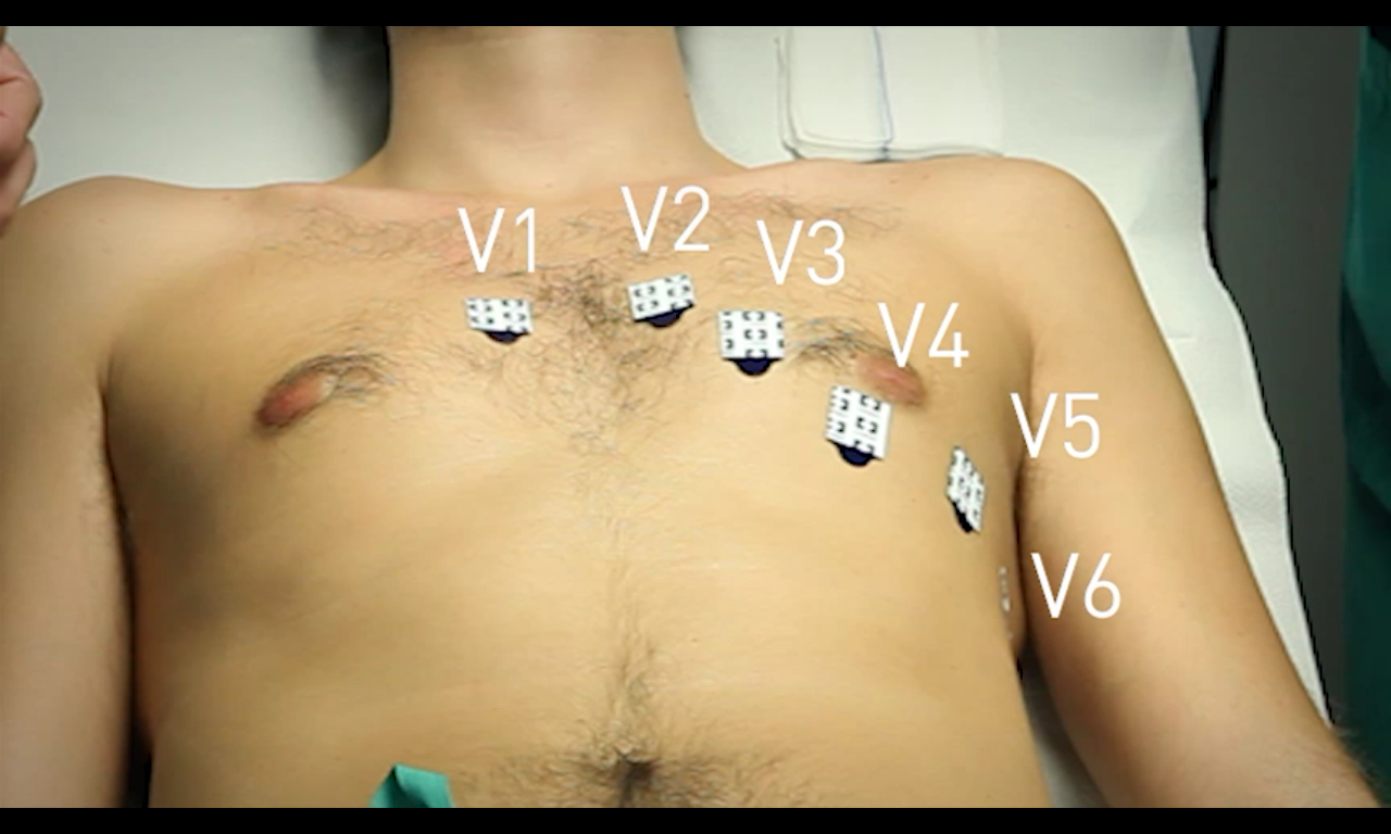 Habilidades en Cardiología截图5