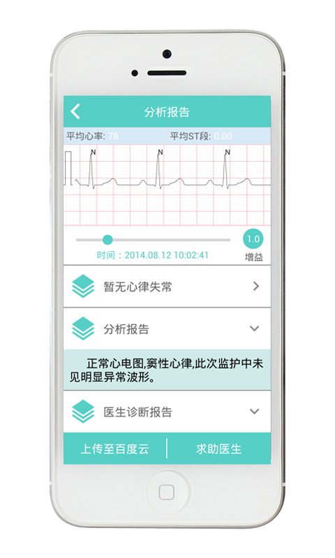 特特心电截图3