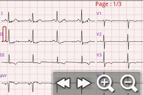 eUno R10 Mobile Telecardiology截图2