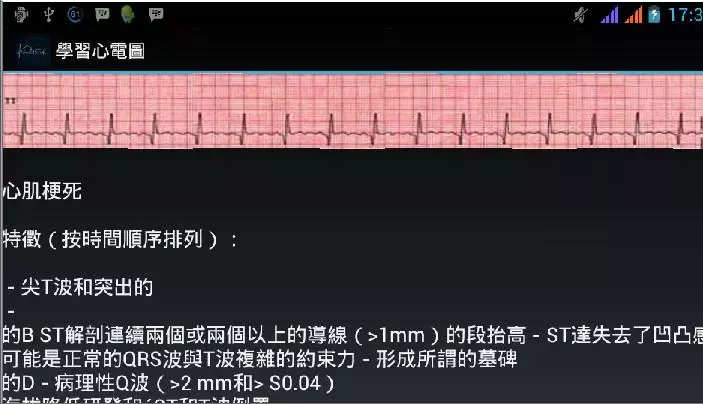 學習心電圖截图5