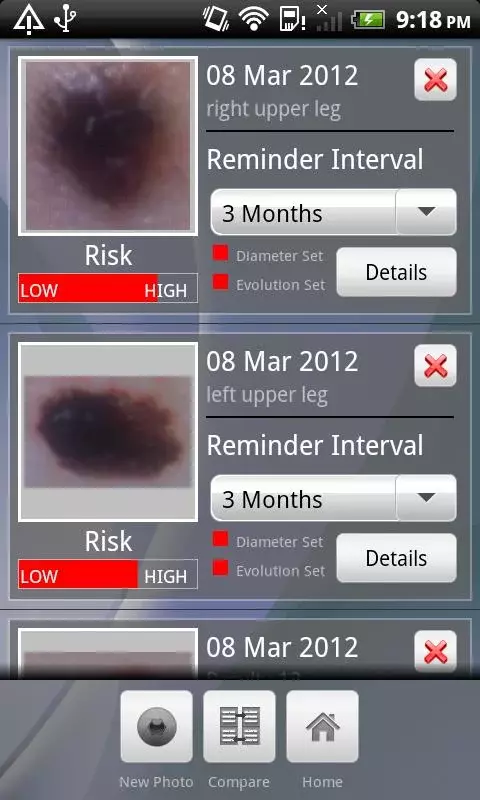 Doctor Mole - Skin cancer app截图4