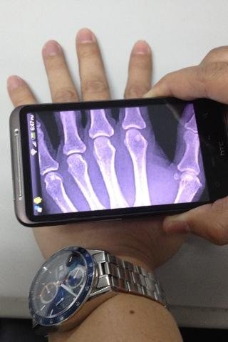 Xray Scan截图2