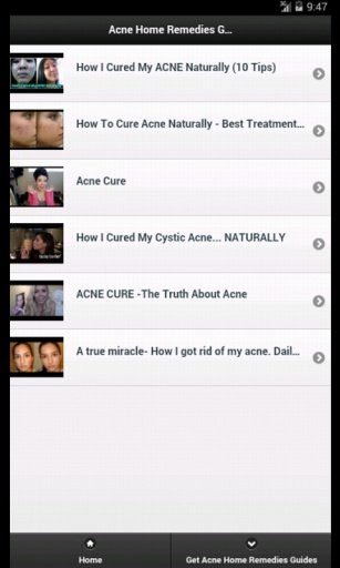 Acne Home Remedies截图5