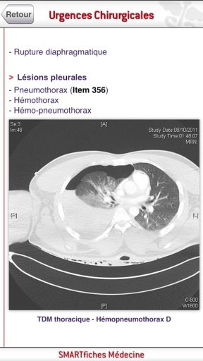 SMARTfiches Urgences Chirurgicales截图8