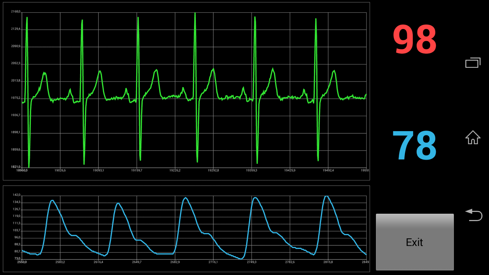 Vital Signs Monitor截图1