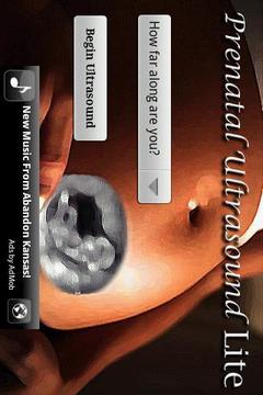 Prenatal Ultrasound Lite截图