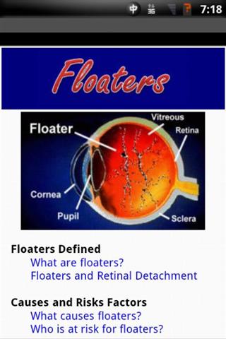 飞蚊症 Floaters截图2