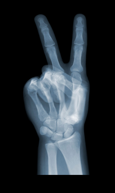 恶作剧X射线扫描仪截图11