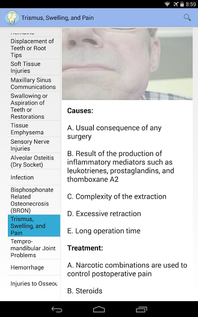 Oral Surgery Complications截图3