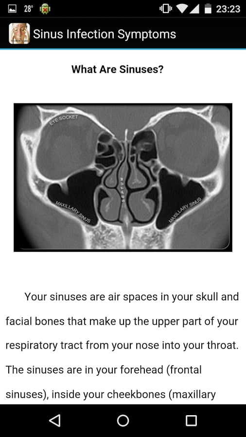 Sinus Infection Symptoms截图2