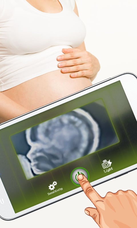 Xray Scanner Pregnancy P...截图1