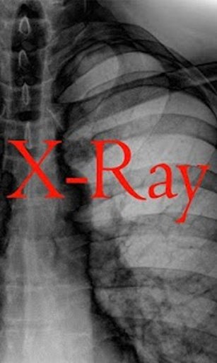 Body X-Ray Scanner - Prank截图3