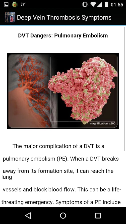 Deep Vein Thrombosis Sym...截图1