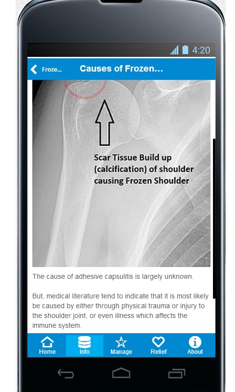 Frozen Shoulder Pain Rel...截图1