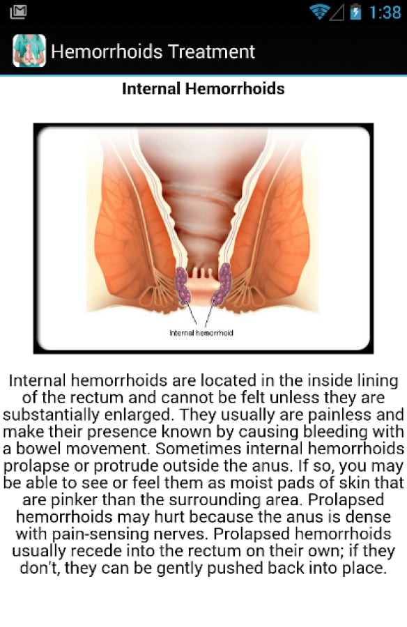 Hemorrhoids Symptoms Tre...截图2