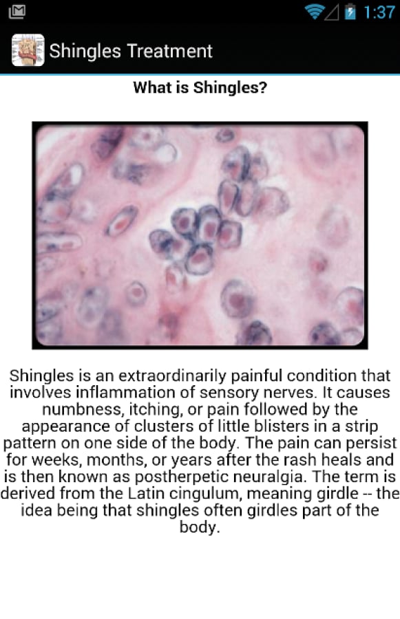 Shingles Symptoms Treatm...截图1