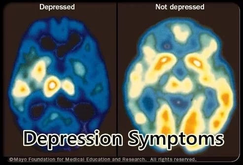 Depression Symptoms截图5