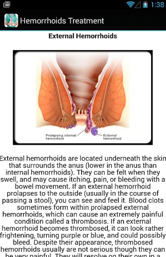 Hemorrhoids Symptoms Tre...截图7