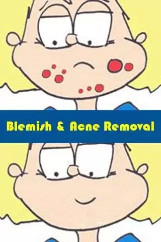 Blemish and Acne Removal截图2