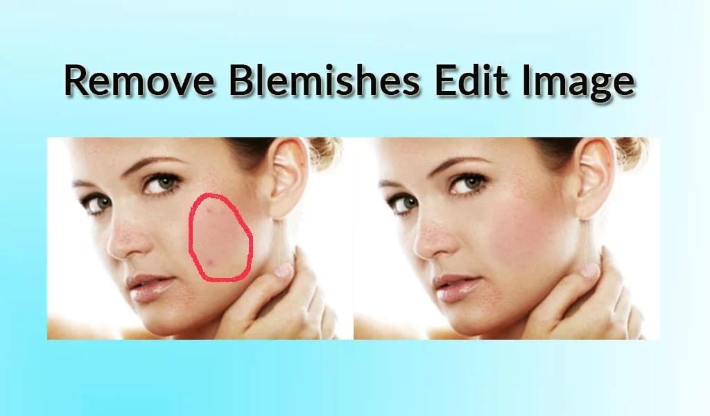 Remove Blemishes Edit Im...截图3