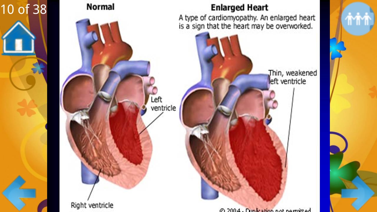 Examination of the heart截图2