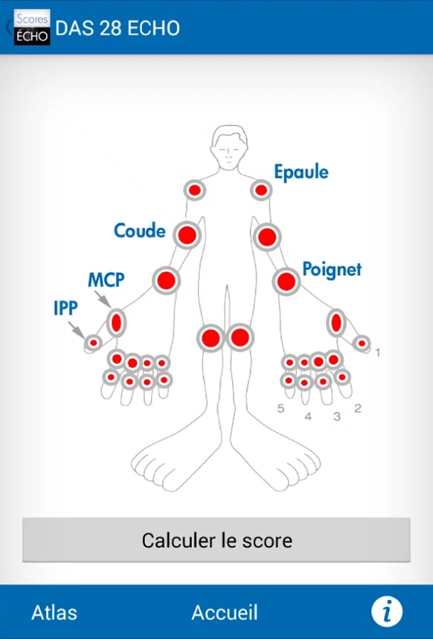 SCORES ECHO截图5