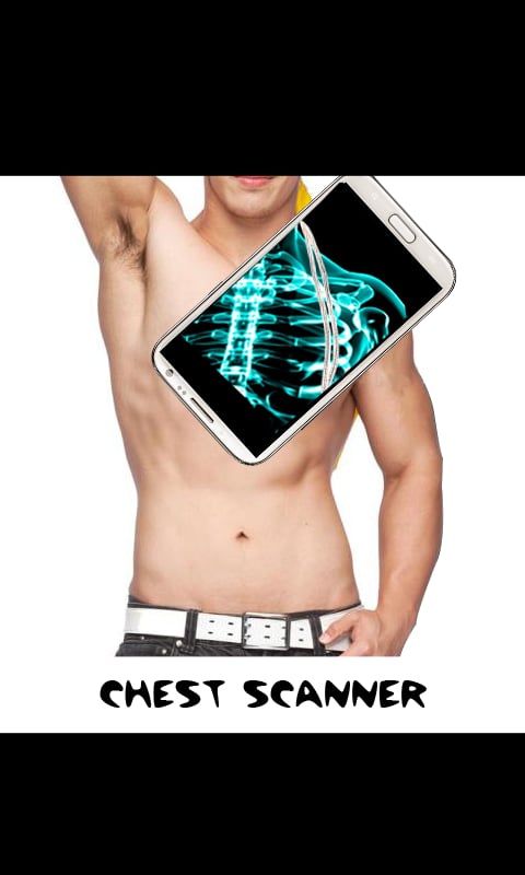 Chest Xray Scanner (Pran...截图1