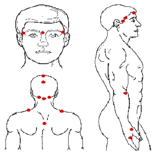 Acupressure Massage截图3