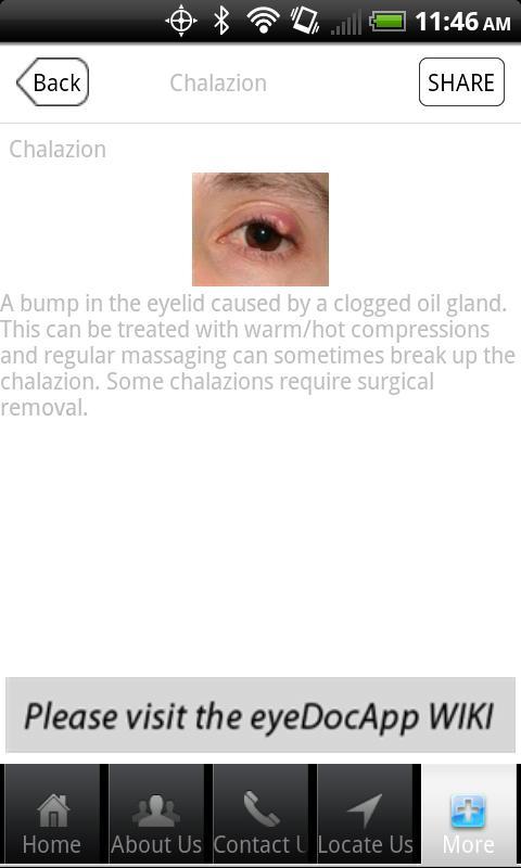 Pro Eye Care截图3