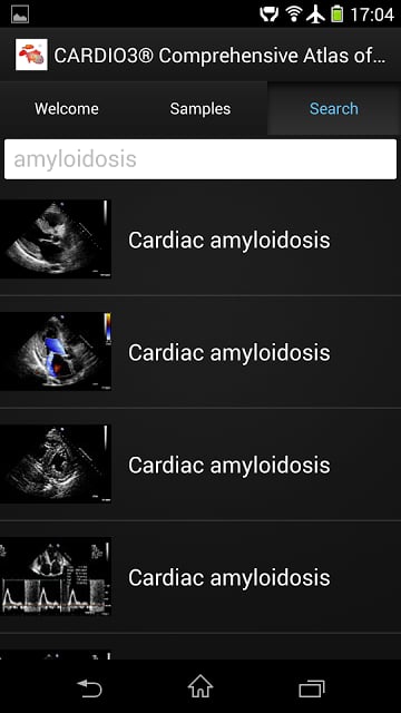 CARDIO3&reg; ECHO - Lite截图7