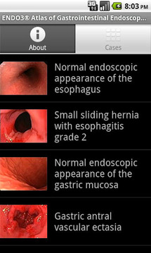 ENDO3&reg;GASTRO - Lite截图