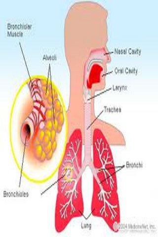 Bronchitis Guide截图4