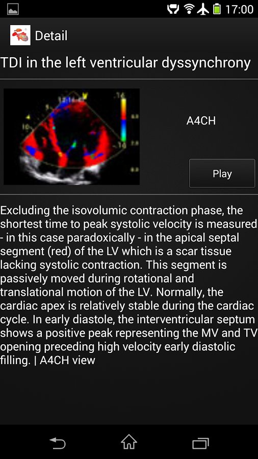 CARDIO3&reg; ECHO - Lite截图1