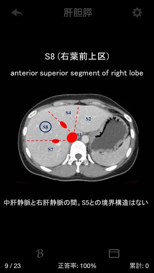 e画像解剖截图4