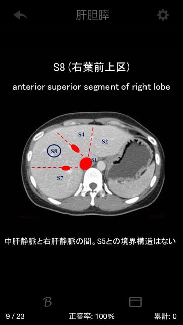 e画像解剖截图10