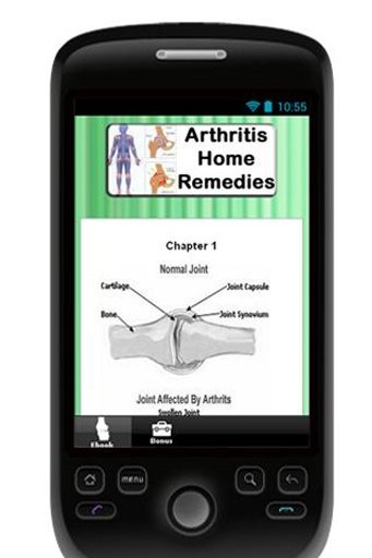 Arthritis Home Remedies截图3