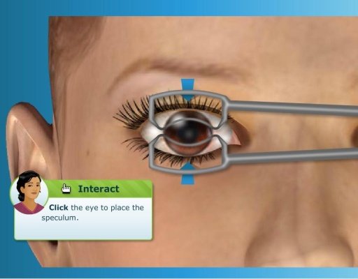 Virtual LASIK Eye Surgery截图7