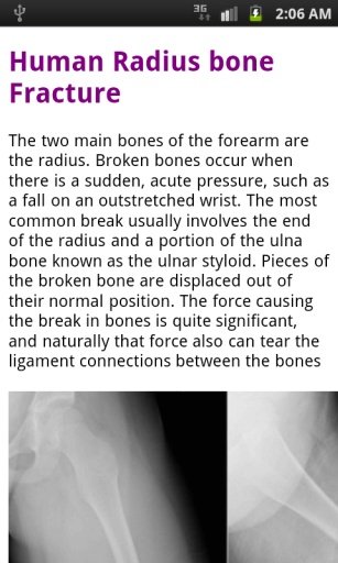 Human Bones learn free截图3