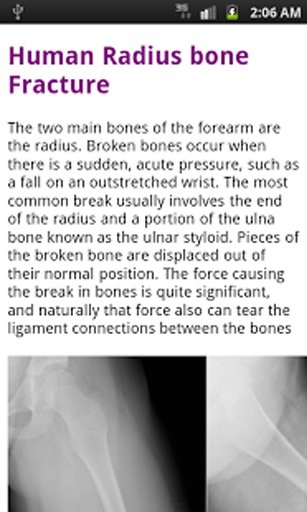 Human Bones learn free截图4