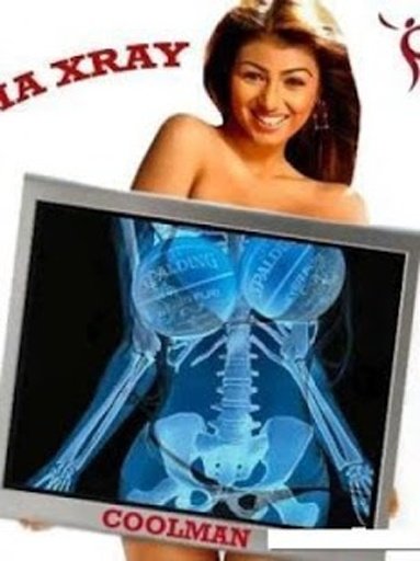 XRay Scan - Scanner X-Ray截图5